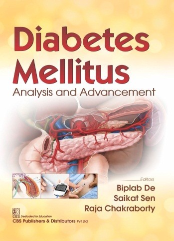 Diabetes mellitus analysis and advancement 