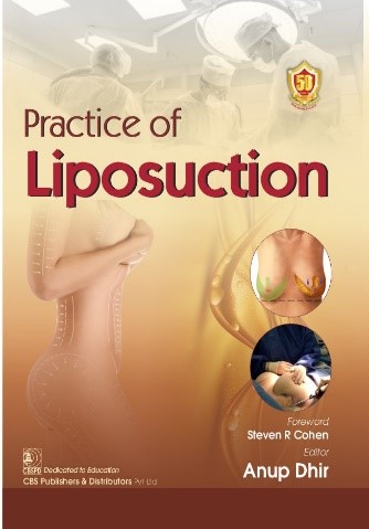 Practice of liposuction