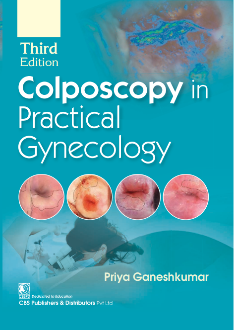 Colposcopy in practical gynecology