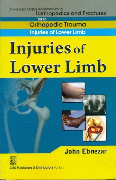 Injuries of lower limb (handbook in orthopedics and fractures vol.19 - orthopedic trauma injuries of lower limb)