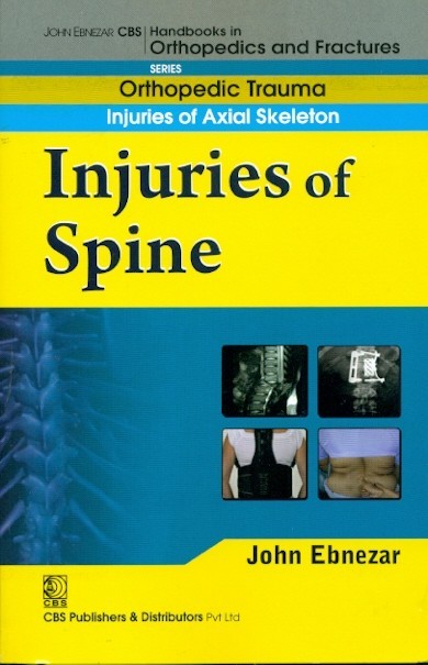 Injuries of spine (handbook of orthopedics and fractures series, vol. 21: orthopedic trauma injuries of axial skeleton )