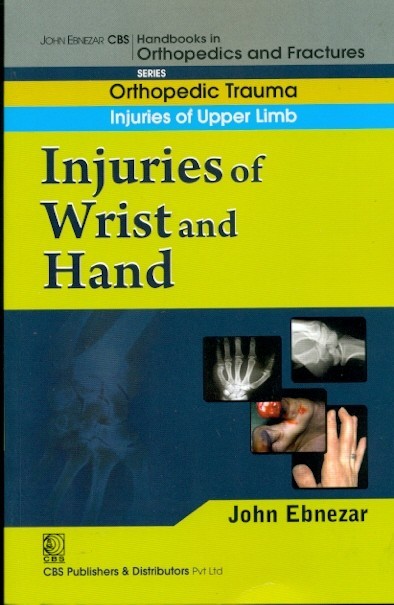 Injuries of wrist and hand (handbook in orthopedics and fractures vol.9 - orthopedic trauma injuries of upper limb)