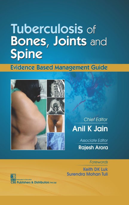 Tuberculosis of bones, joints and spine - evidence based management guide