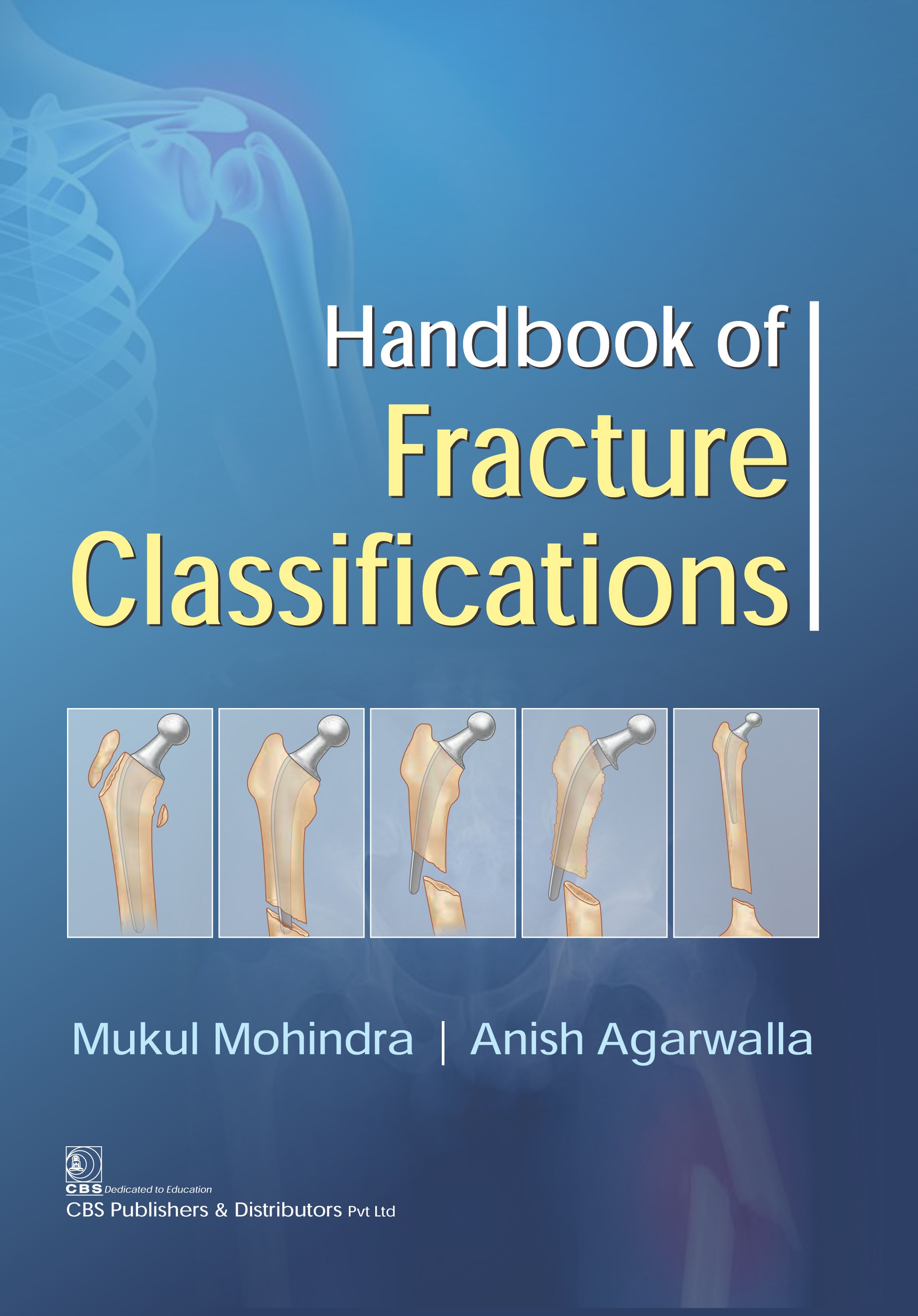 Handbook of fracture classifications