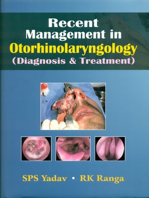 Recent management in otorhinolaryngology: diagnosis & treatment 