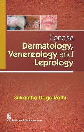 Concise dermatology venereology and leprology (pb 2017)