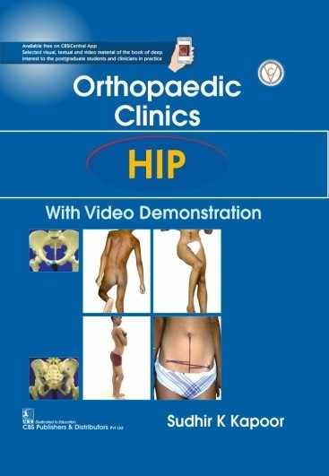 Orthopedic clinics hip with video demonstration