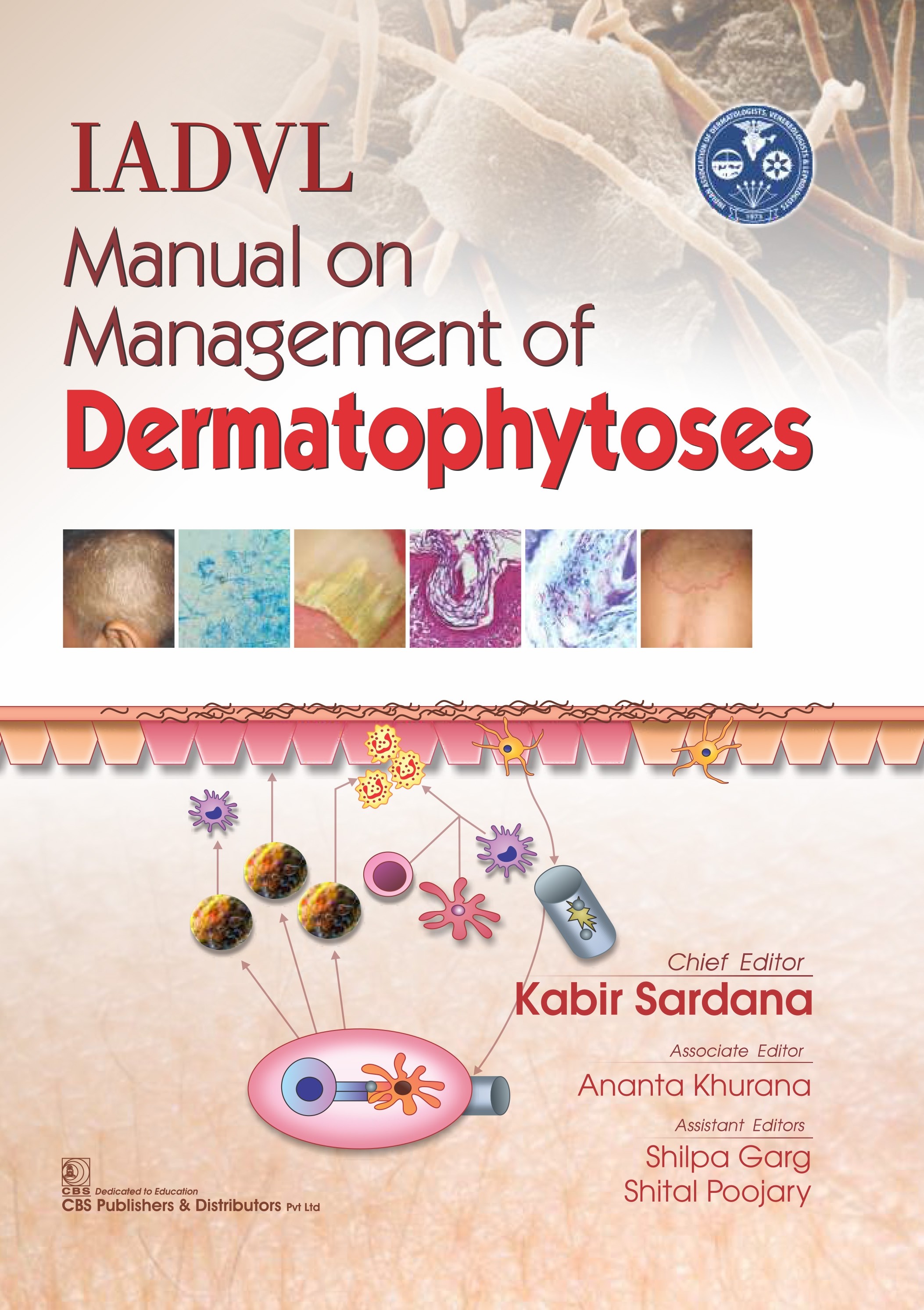 Iadvl manual on management of dermatophytoses