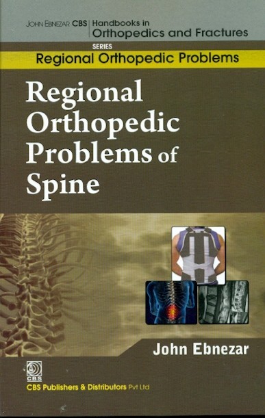Regional orthopedic problems of spine (handbooks in orthopedics and fractures series, vol. 50: regional orthopedic problems)