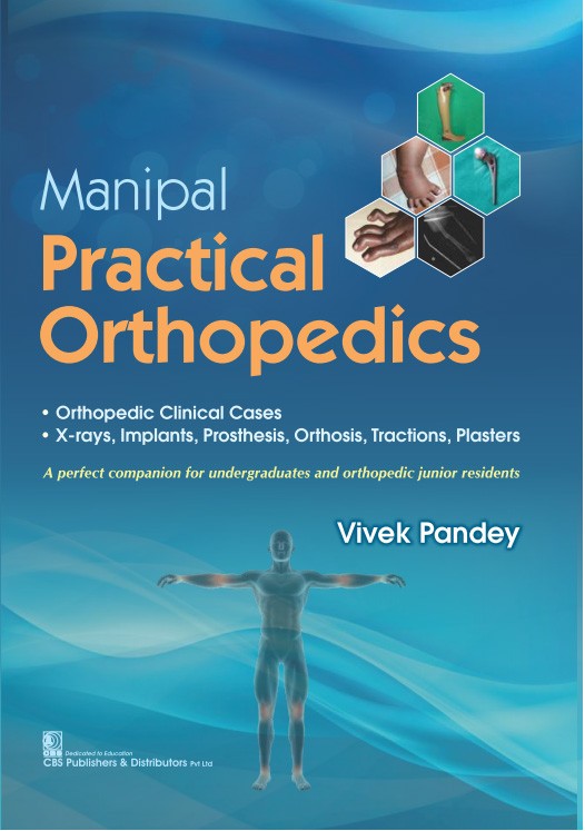 Manipal practical orthopedics