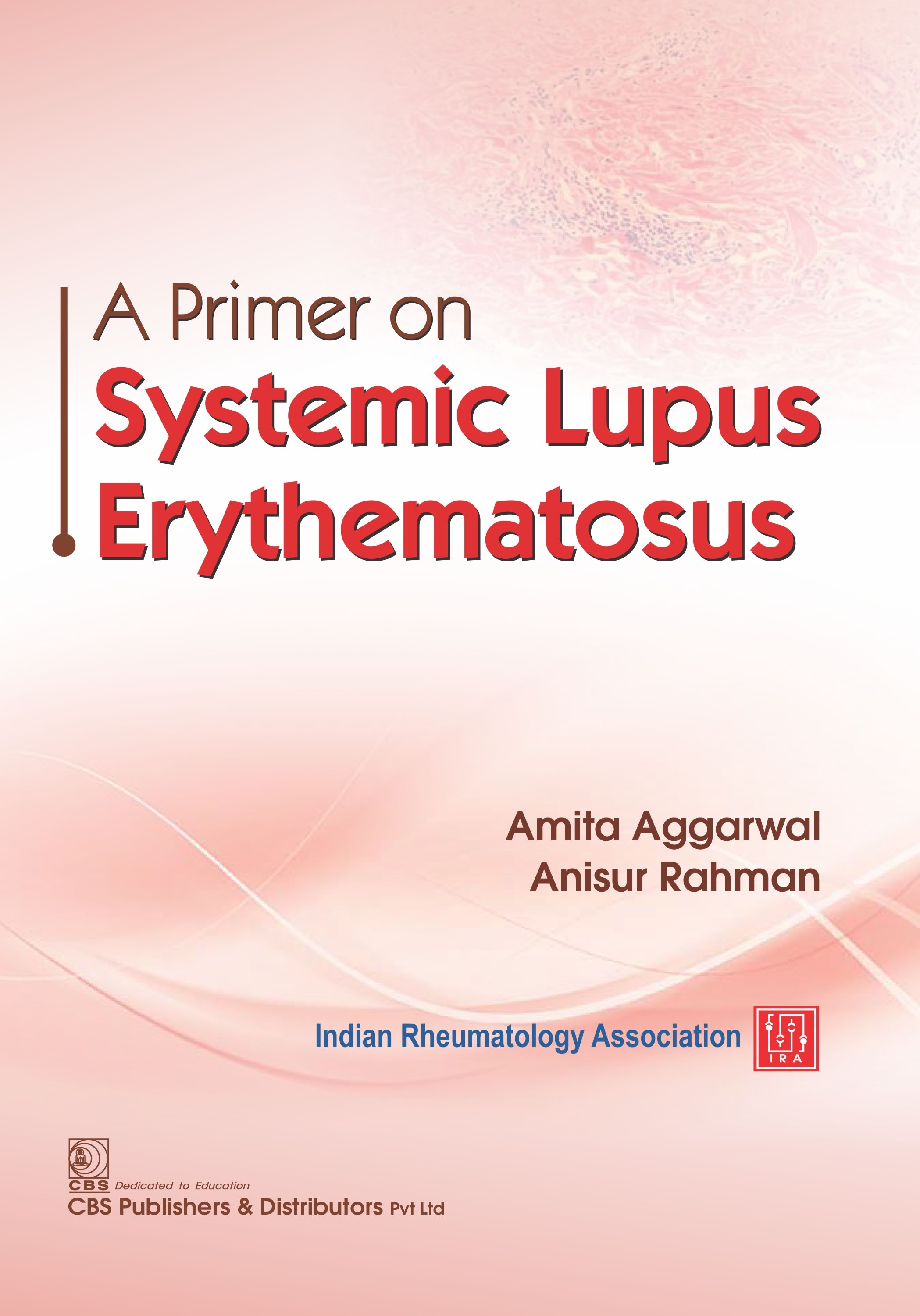 A primer on systemic lupus erythematosus