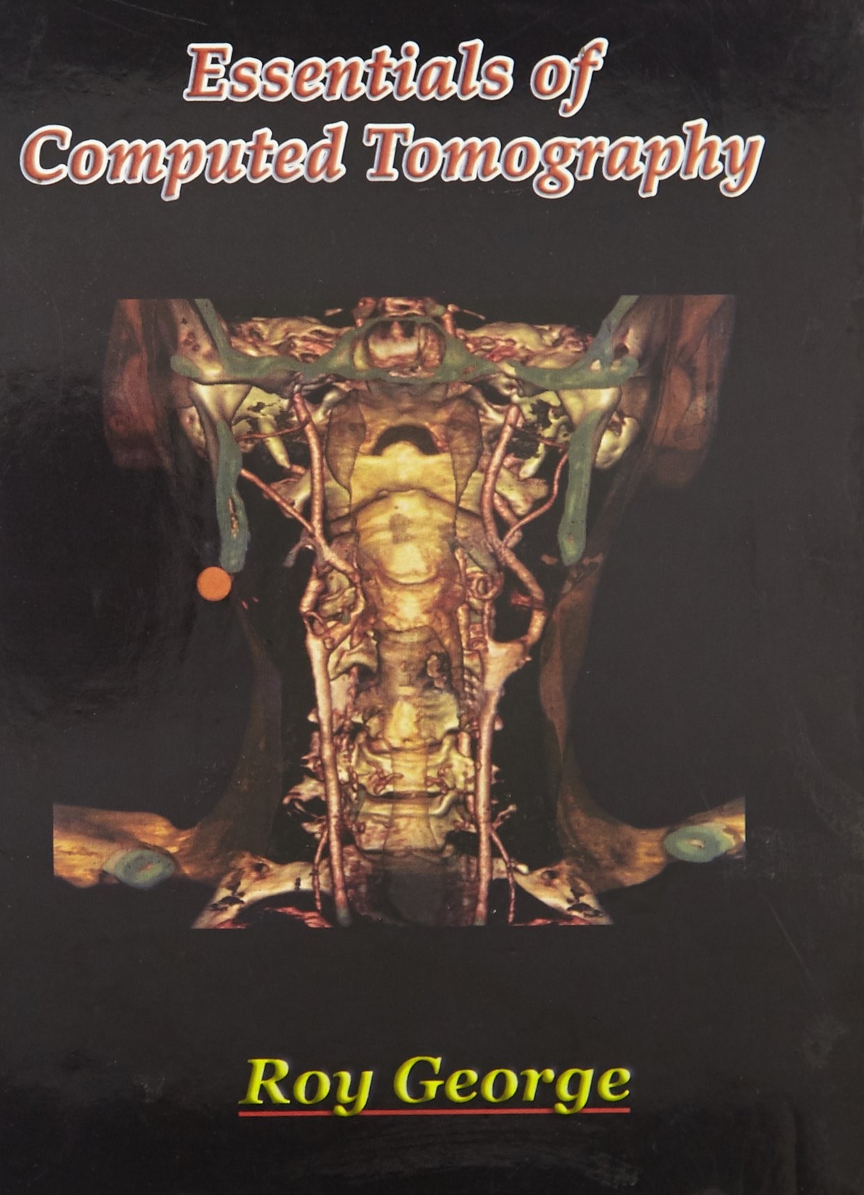 Essentials of computed tomography